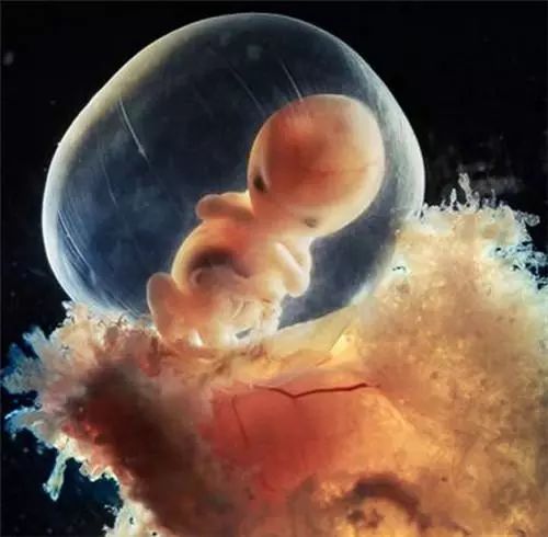 胎儿大约有20厘米长头上开始出现