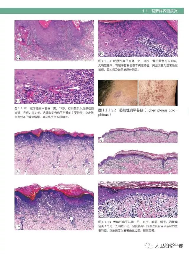 973种皮肤病有图临床图片有真相病理图片实用皮肤组织病理学第2版新书