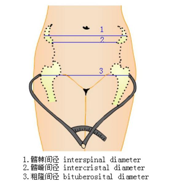 骨盆各种尺寸测量图片