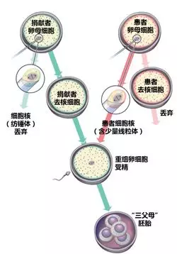 纺锤体简图图片