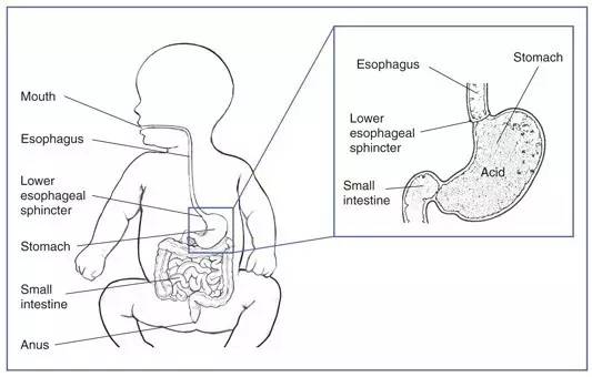 新生儿胃的解剖结构图图片