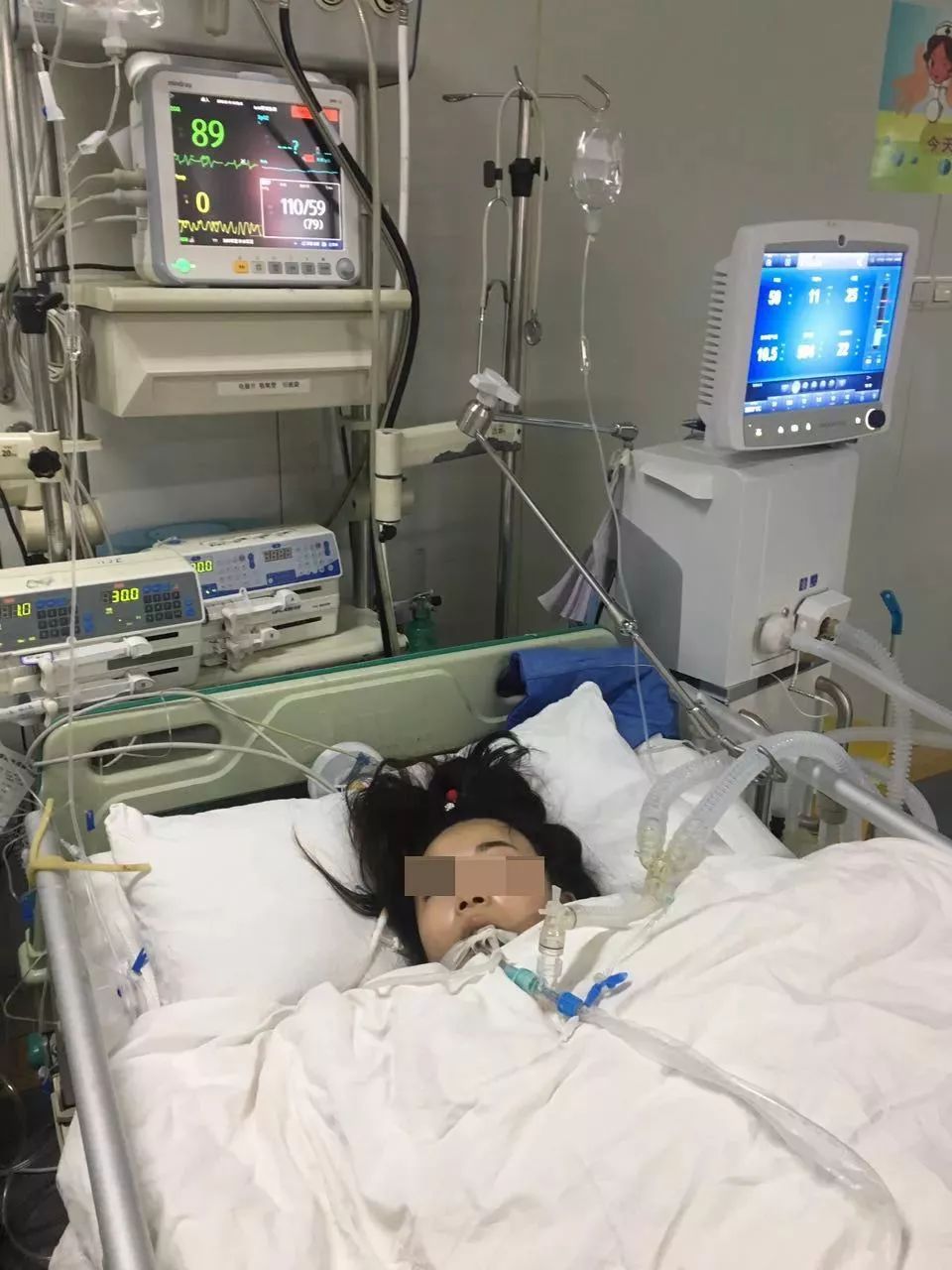 當完伴娘,24歲女孩休克嘔吐,右腿截肢!竟是因為這種常見小毛病