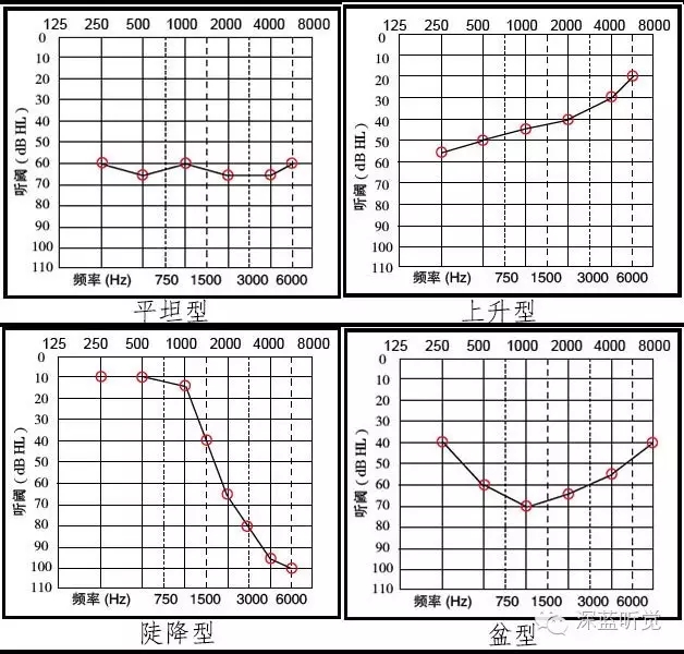 正常的听力检测图图片