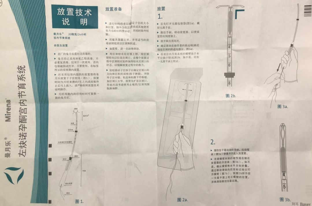 曼月乐环放置图解图片