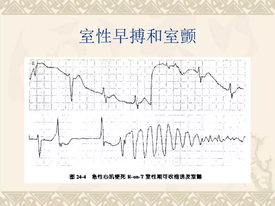 心脑健康卫士"健康心脏"房扑房颤不要怕