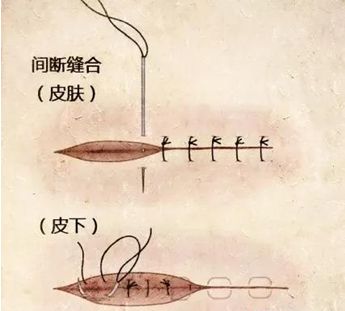 猪场技术外科手术缝合你学会了吗