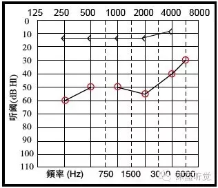 听力图也可以大概判断听损类型