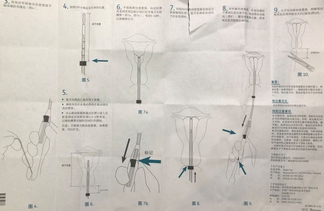 曼月乐安装图片