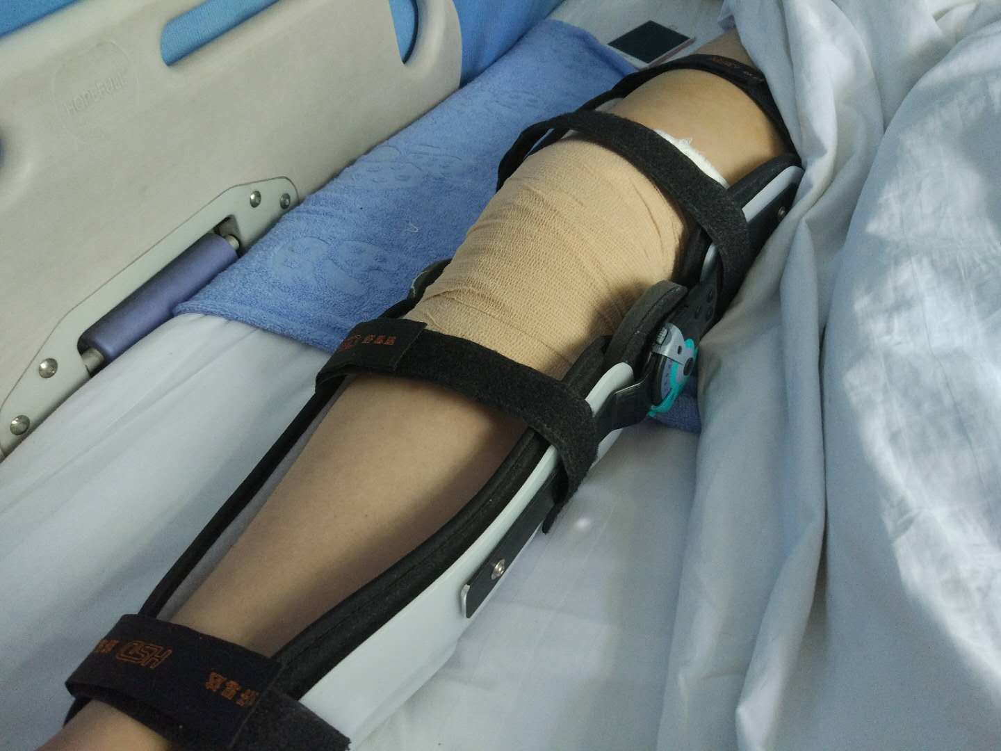 主任医师窦榆生介绍,小黄经初步诊断为右膝关节前叉下止点撕脱骨折