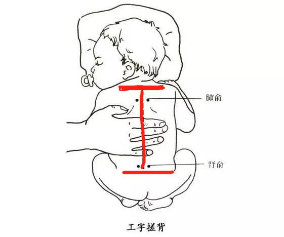 方法 用掌根或者大小鱼际在宝宝的脊背做工字型快速往返摩擦