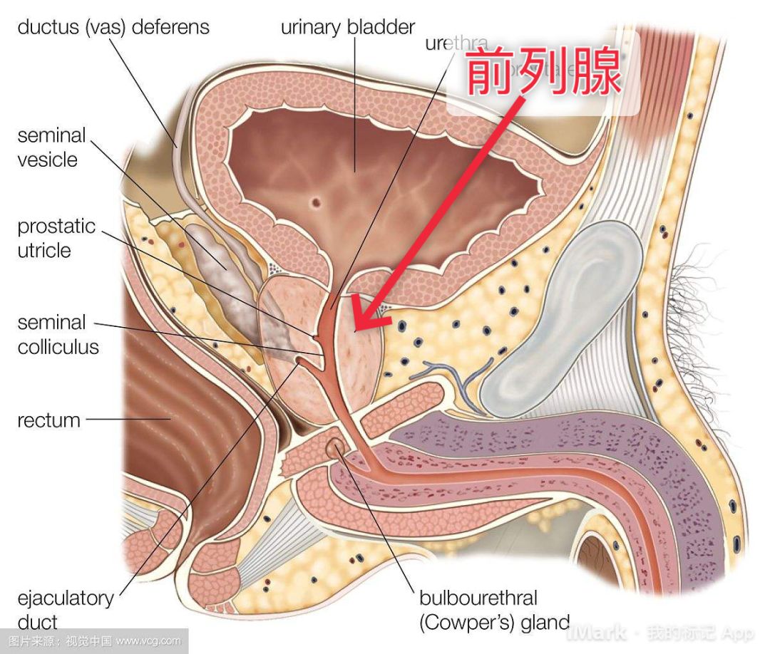 男性专属癌前列腺癌