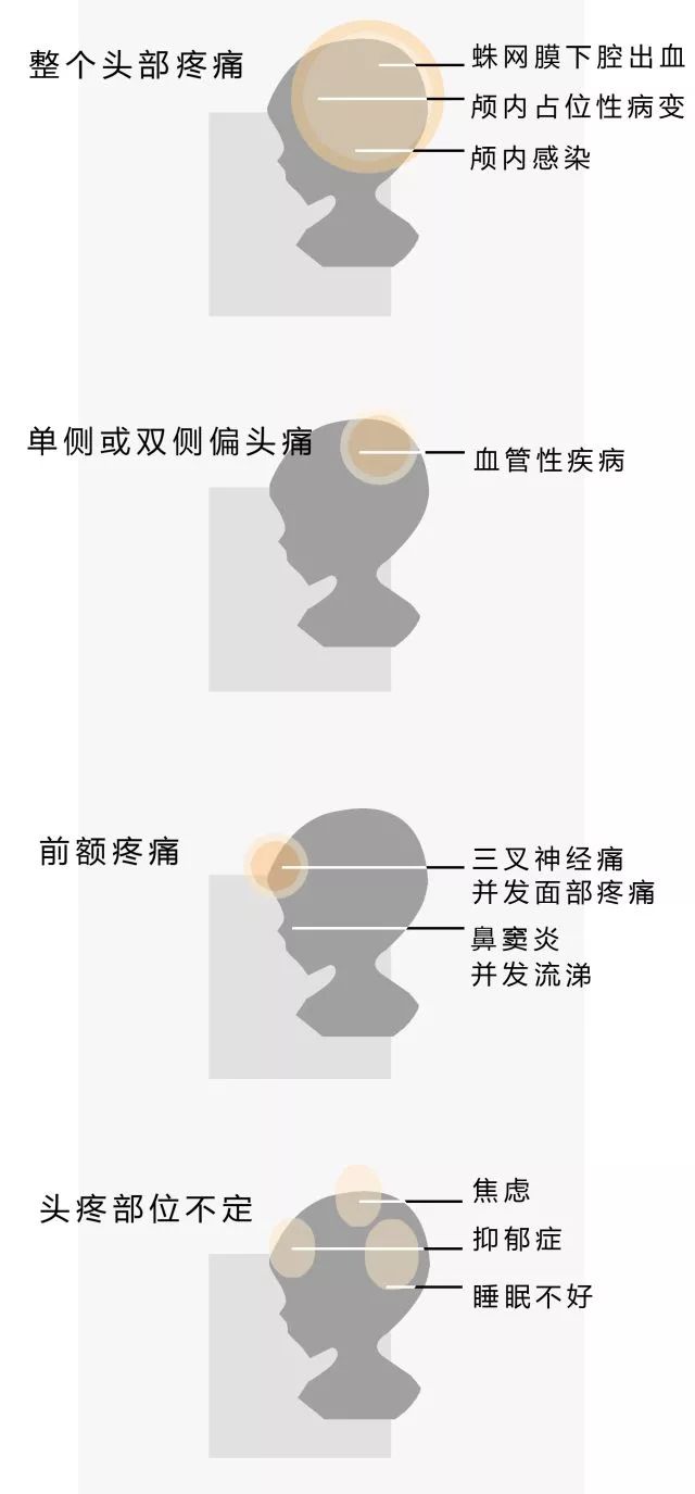 7类头痛,10类头晕,傻傻分不清?