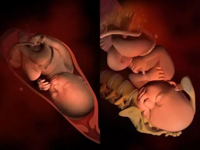 原来胎儿在妈妈肚子里是这样一点一点长大的!真是太神奇了!