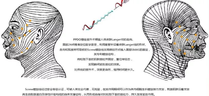 1861年,澳大利亚解剖学家karl langer首次提出了"皮肤朗格线.