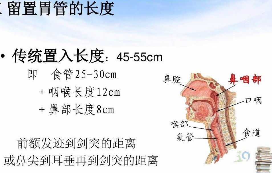 为什么要插胃管插胃管难受吗什么时候可以拔除胃管