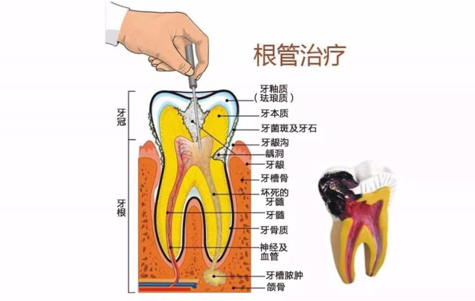 牙根分布示意图图片