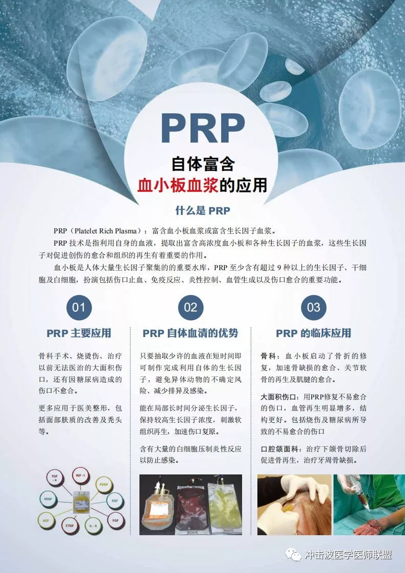 prp-运动损伤和骨关节炎的最佳疗法