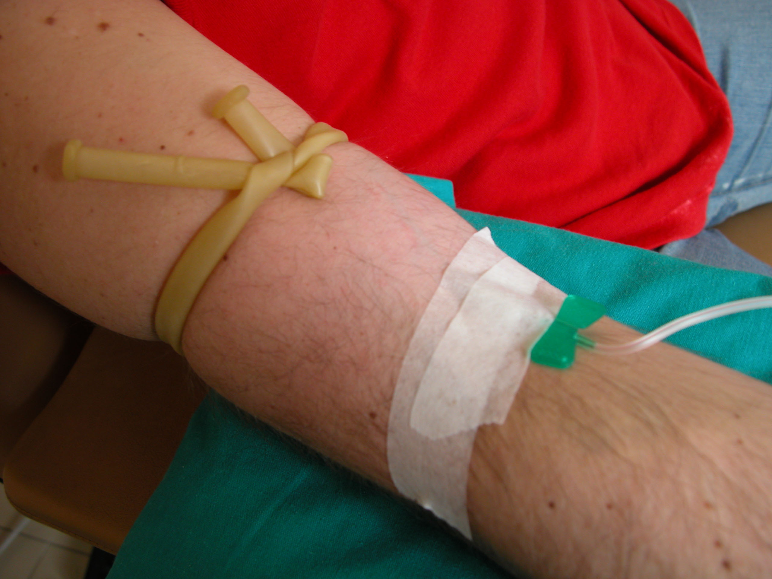我们在献血,打针输液的时候如果共用一个注射器可能就会出现,梅毒的