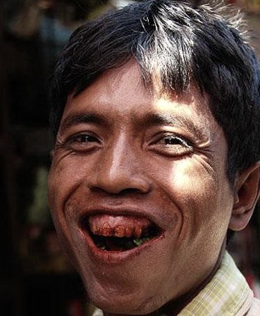 常年吃槟榔的牙齿图片,吃槟榔的牙齿