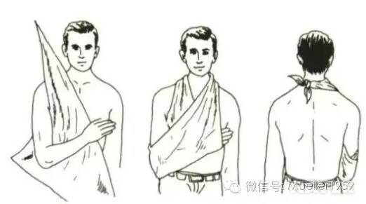 手臂和膝盖包扎头部包扎(2)三角巾包扎法:三角巾应用方便,适用于全身