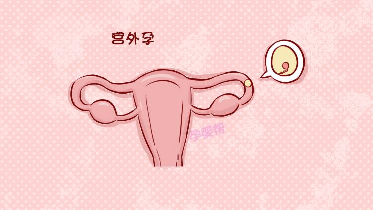 怀孕初期粉色分泌物图片