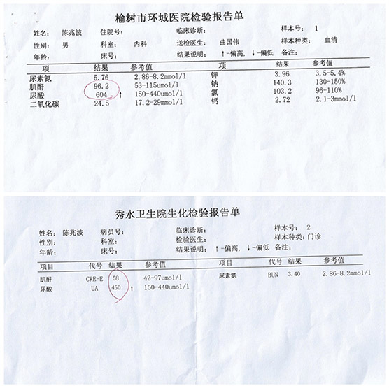 優點:溶石不侷限,可溶解人體各處痛風石;抑制嘌呤代謝,不生成新尿酸