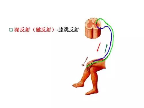 还有一种好玩的反射叫光喷嚏反射(photic sneeze reflex):看见太阳