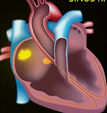 心脏血液流动动态图图片