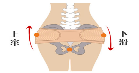 赫曼雙菱形骨盆帶,它是由兩個菱形結構組成,分別科學固定兩側突起的