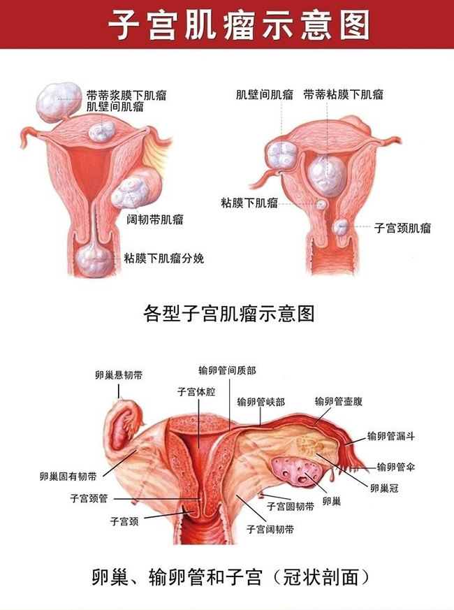 人体子宫位置图图片