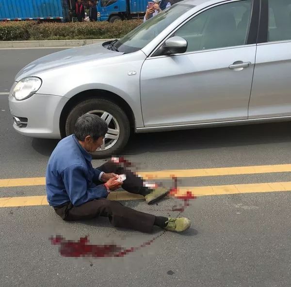 常州金坛华城路发生一起车祸,伤者瘫坐在地,流了好多血!