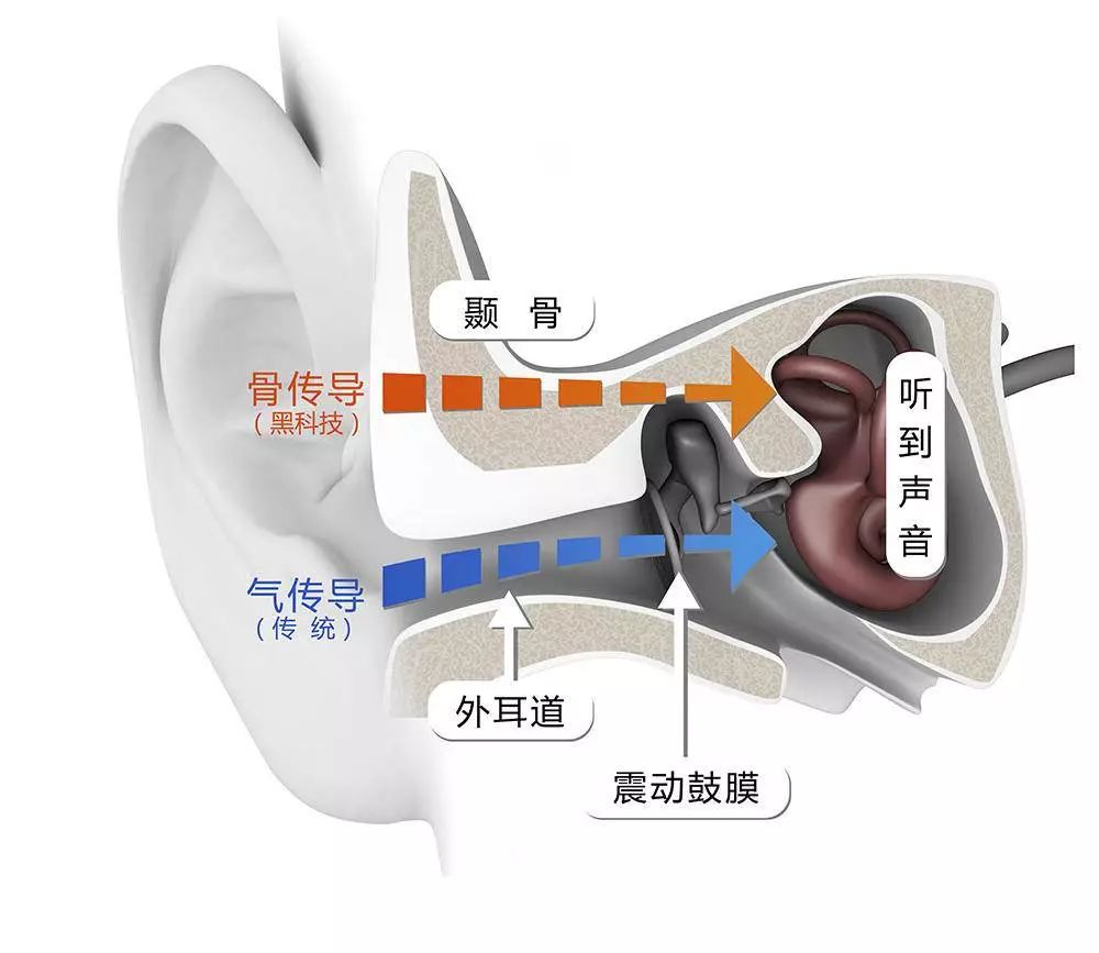 它就是今天一條生活館要推薦的,