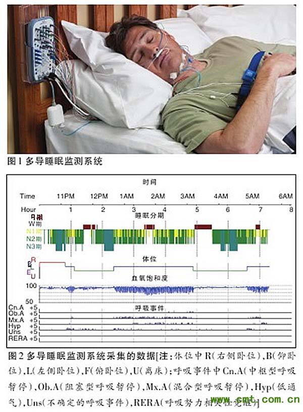 睡眠中心採用的是進口全套多導睡眠呼吸監測設備,在全夜睡眠過程中