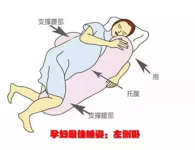 胎盘低卧床姿势图图片