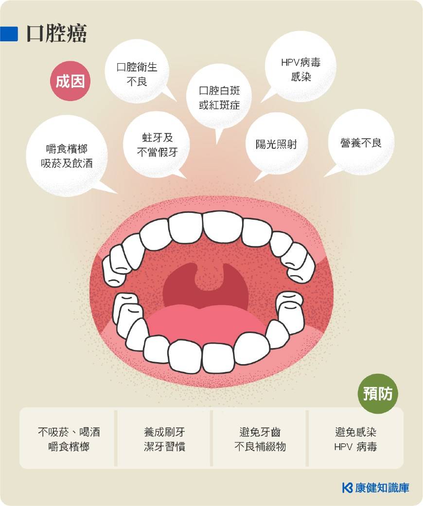 槟榔该为口腔癌负责吗?吃过槟榔和还在吃槟榔的你,一定要注意