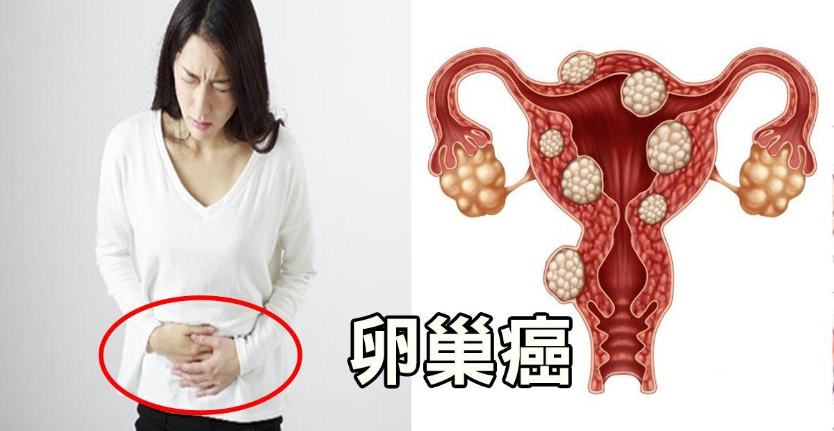 120斤的大腫瘤卵巢如何能承受其重