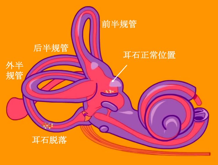 我们每一侧的内耳里都有3个半圆形的半规管和2个囊(椭圆囊和球囊)