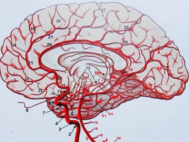 脑血管简笔画图片