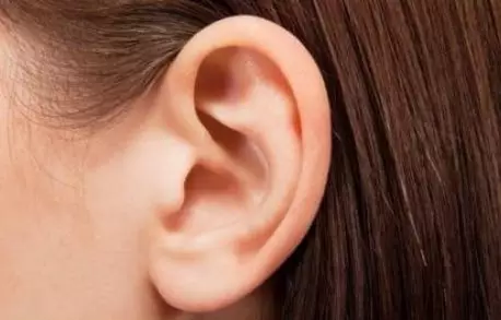 1, 耳朵轮飞廓反一般来说耳朵轮飞廓反,也是耳轮外张,耳廓向外突出