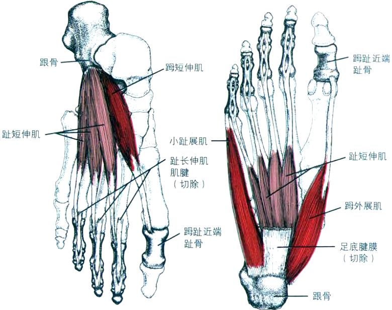 激痛点疗法小趾外展肌