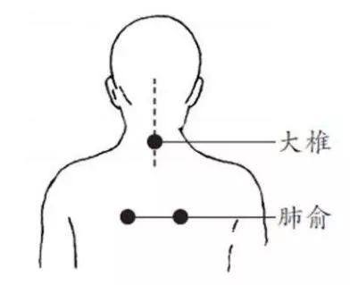 感冒背部刮痧图解图片