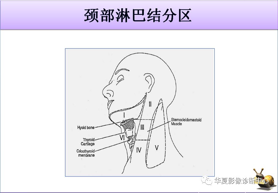 颈部淋巴结分区与病变的ct签别诊断