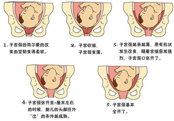 顺产后的宫颈图片图片