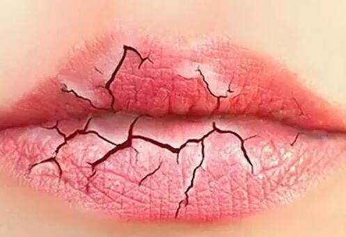 健康须知 女性不关心双唇 美丽 健康都不要了