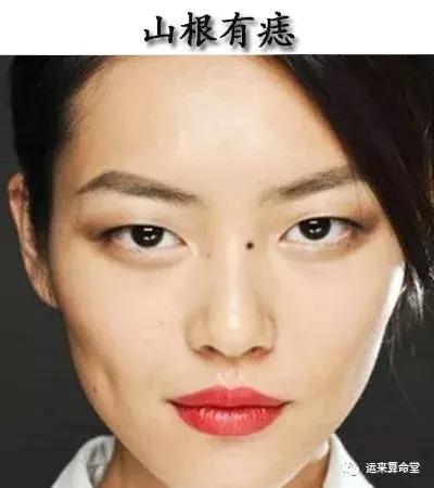 女人山根(疾厄宮)上有痣,先天體質差,後天容易身體不適,並且還會生纏