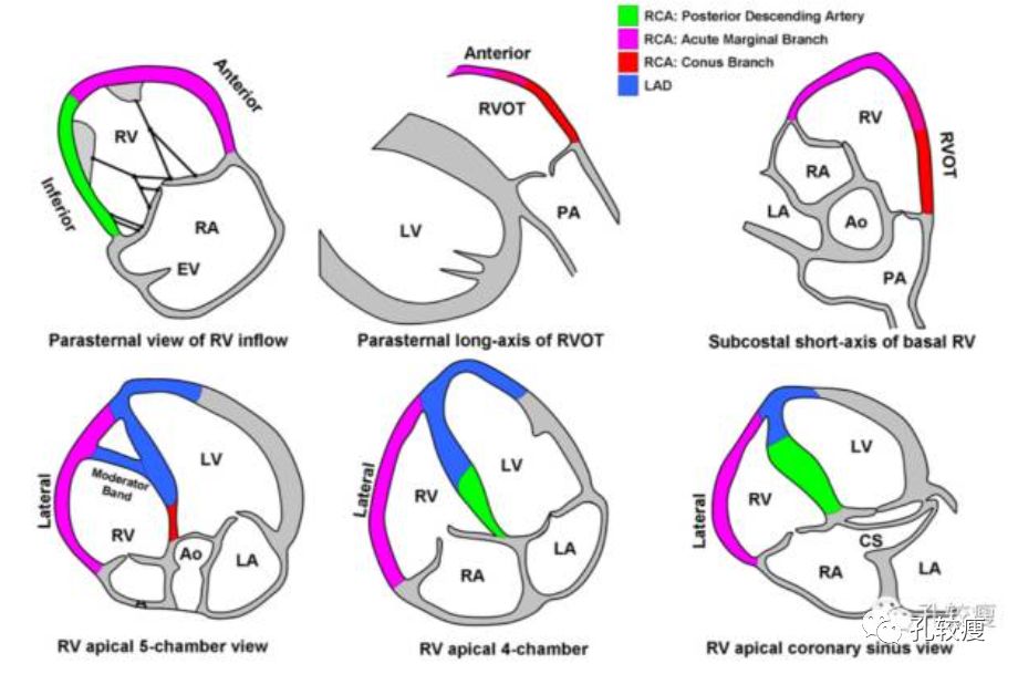 右心室节段划分及其与冠脉的供血分布四,前间壁心肌梗死这一诊断术语