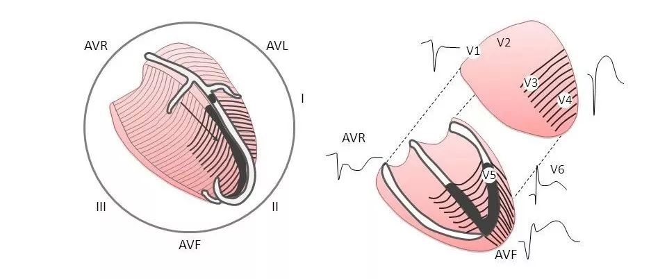 左心室的节段划分流派众多,包括十六节段法,十七节段法,十八节段法.