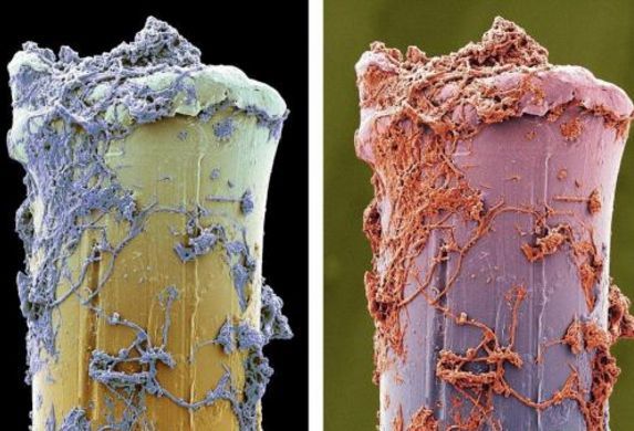 显微镜下的细菌 鼻屎图片