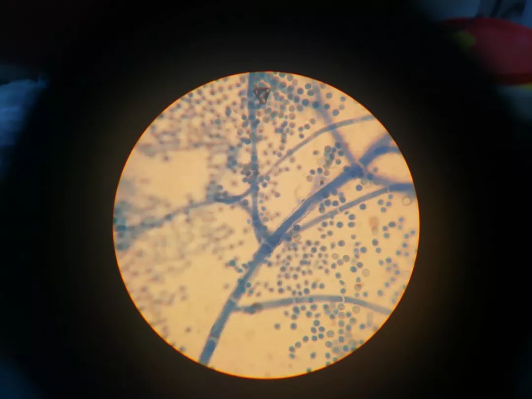 黄曲霉显微镜图片图片