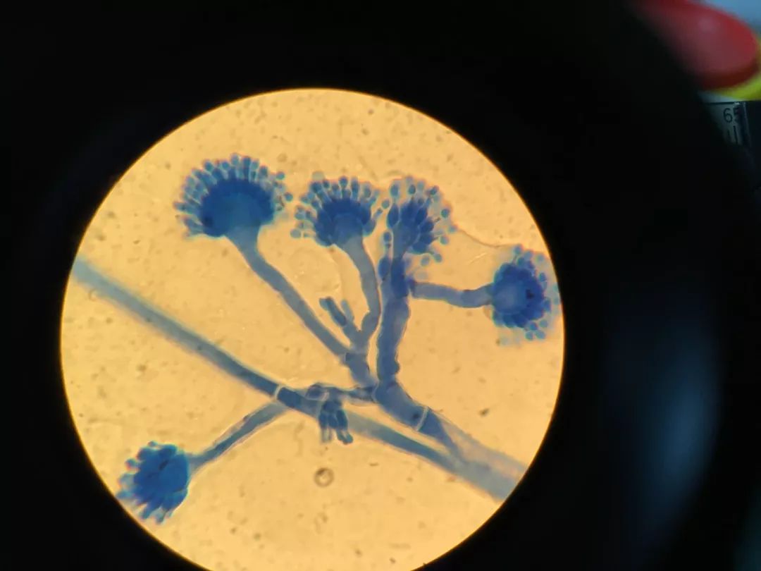 师宋衍丽在日常的工作中,积累了霉菌等如花般绽放在显微镜下的图片!